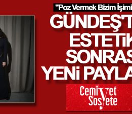 Ebru Gündeş’ten estetik sonrası yeni paylaşım